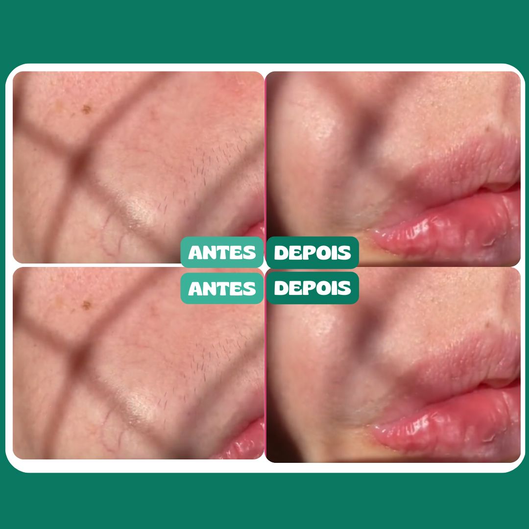 FlawLess© Depiladora Facial Indolor