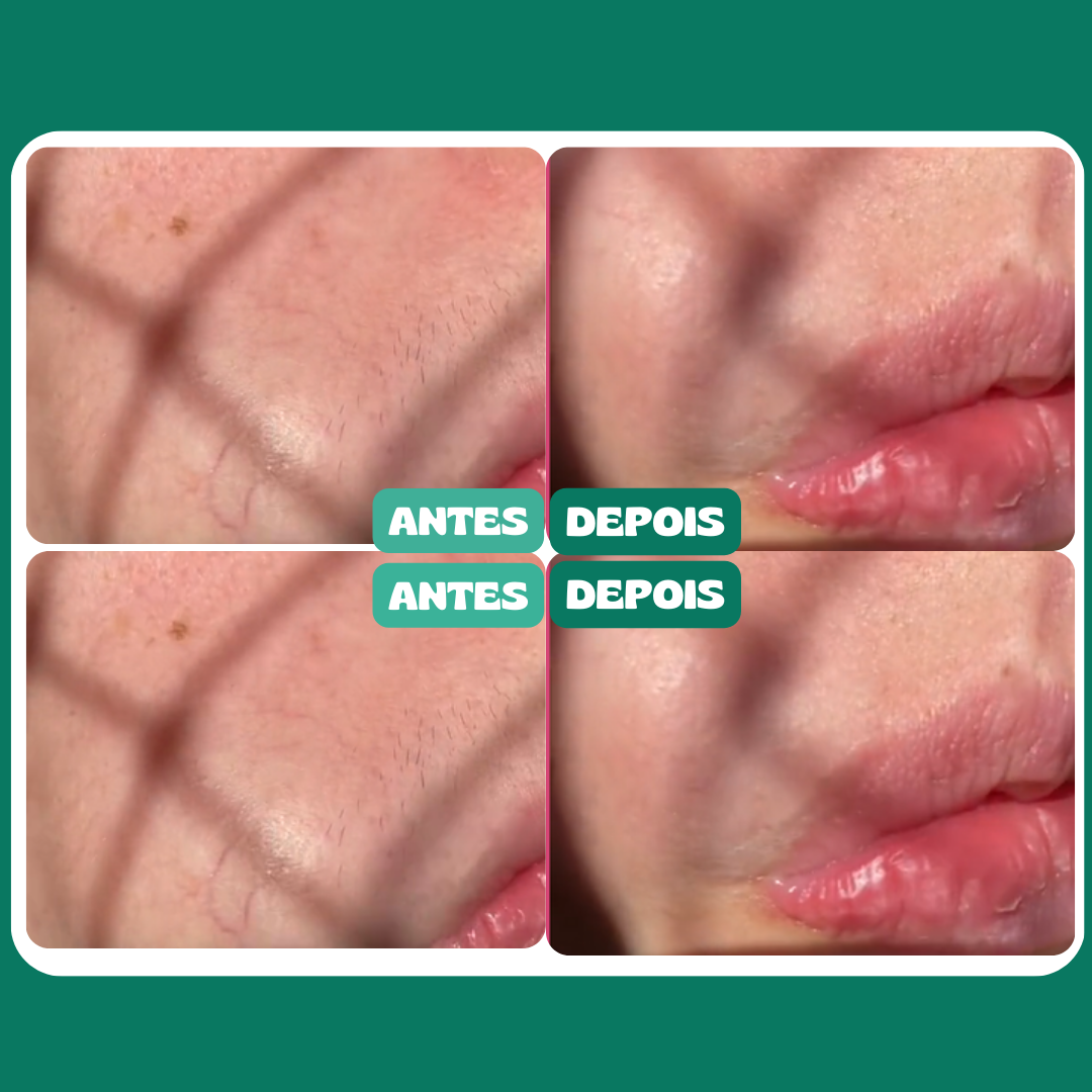 FlawLess© Depiladora Facial Indolor - 50% de Desconto - ENVIO EM 72Hrs