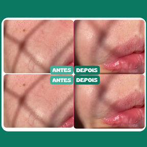 FlawLess© Depiladora Facial Indolor