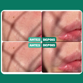 FlawLess© Depiladora Facial Indolor - 50% de Desconto - ENVIO EM 72Hrs